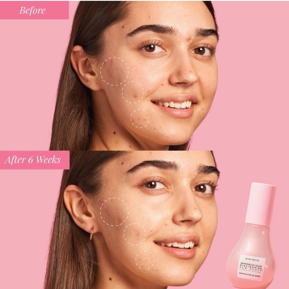 Glow Recipe Watermelon Glow Niacinamide Dew Drops - Picture 8 of 8